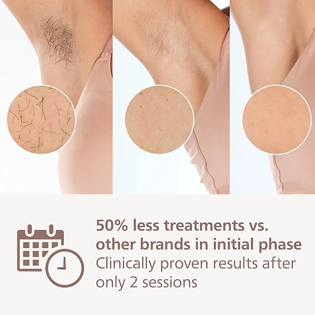 IPL (لیزر خانگی) فیلیپس مدل BRI958